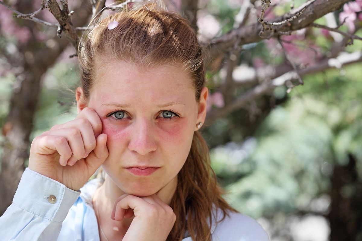 Allergic Conjunctivitis in Children: A Comprehensive Guide to Symptoms, Treatment, and Soothing Relief