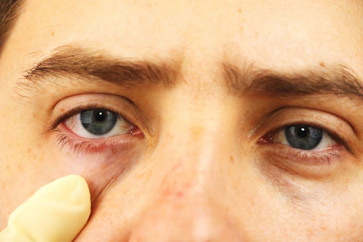 More Than 3 Hours on Screens? Here's How Contact Lens Users Can Avoid Dry Eyes
