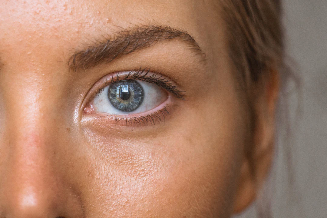 Lifestyle Changes to Alleviate Dry Eye Problems